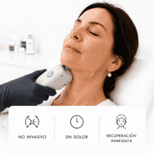 HIFU Facial | Lifting Facial No Quirúrgico
