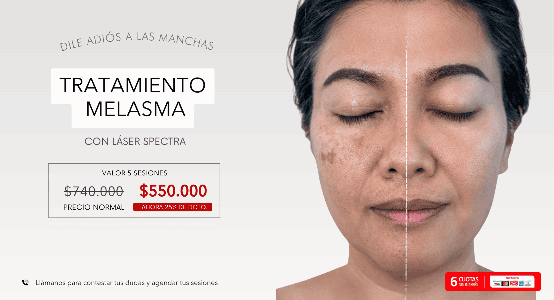 promo-tratamiento-melasma-new-sin-evaluacion