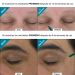 Antes y Después Tratamiento AOX+ Eye Gel
